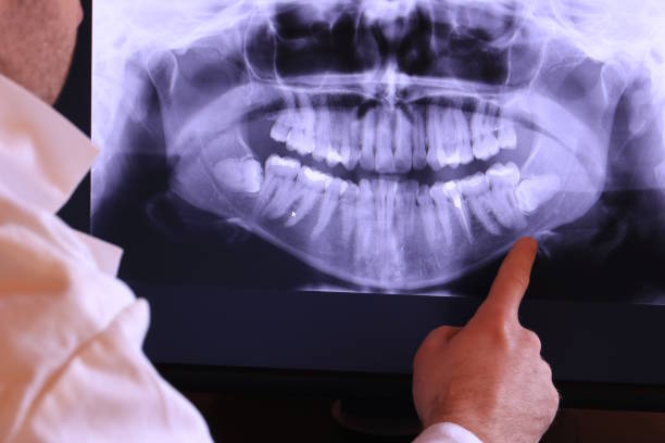 Best Emergency Dental Care for Broken or Chipped Teeth in Guin, AL